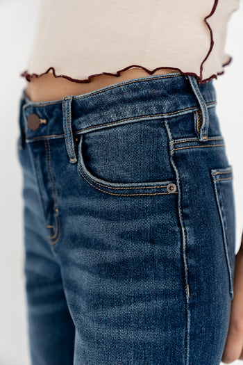 Button, Zipper Closure